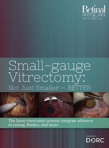 The latest vitrectomy systems integrate advances in cutting, fluidics, and more